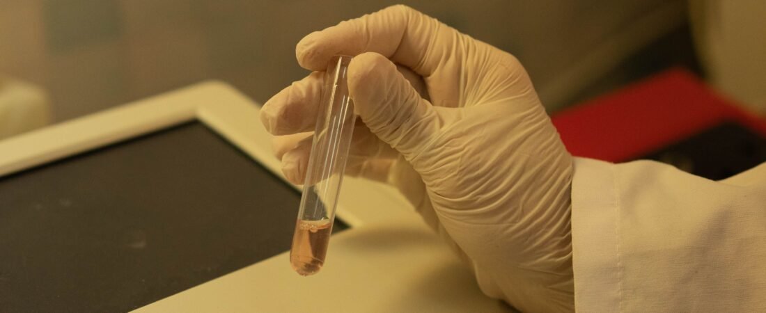 ¿Qué es un laboratorio de referencia? Función, beneficios y cuándo recurrir a uno